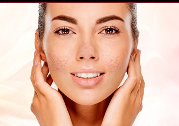 Natural Ingredients to Fight Pigmented Skin!