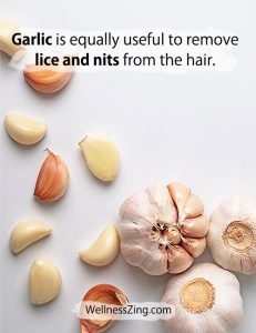 Garlic is Useful in Removing Lice and Nits from Hair