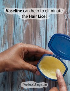 Vaseline Can Help to Eliminate the Hair Lice