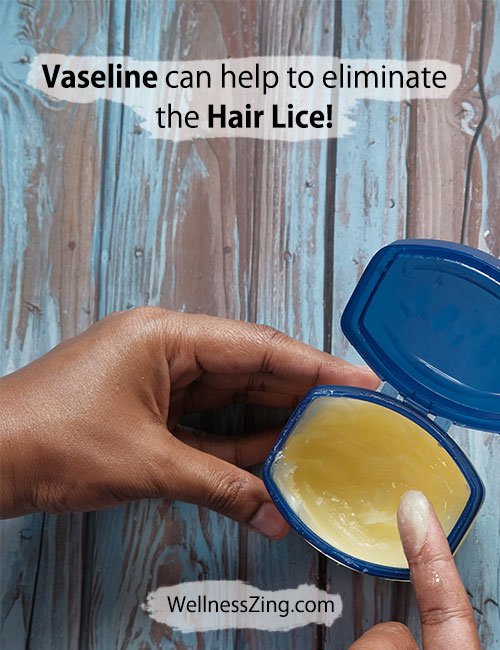 Vaseline Can Help to Eliminate the Hair Lice