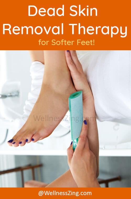 Dead Skin Removal for Soft Feet