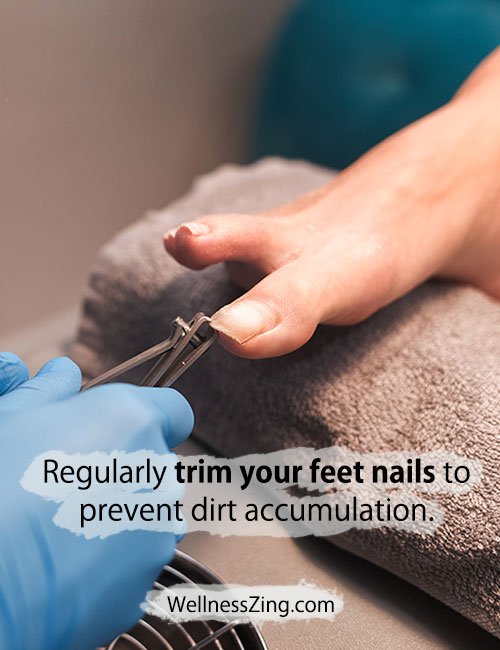 Trim Your Feet Nails Regularly