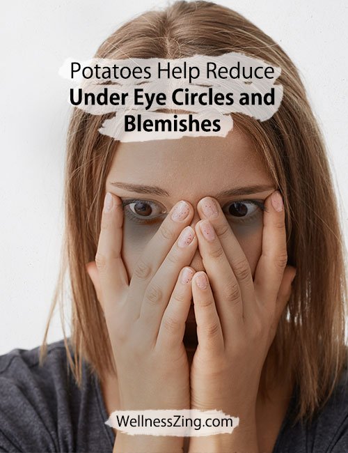 Potato Helps Reduce Under Eye Circles and Blemishes