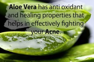 Aloe vera has anti oxident and healing properties to treat acne