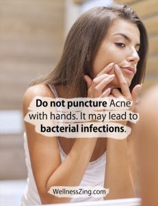 Do not puncture acne on face