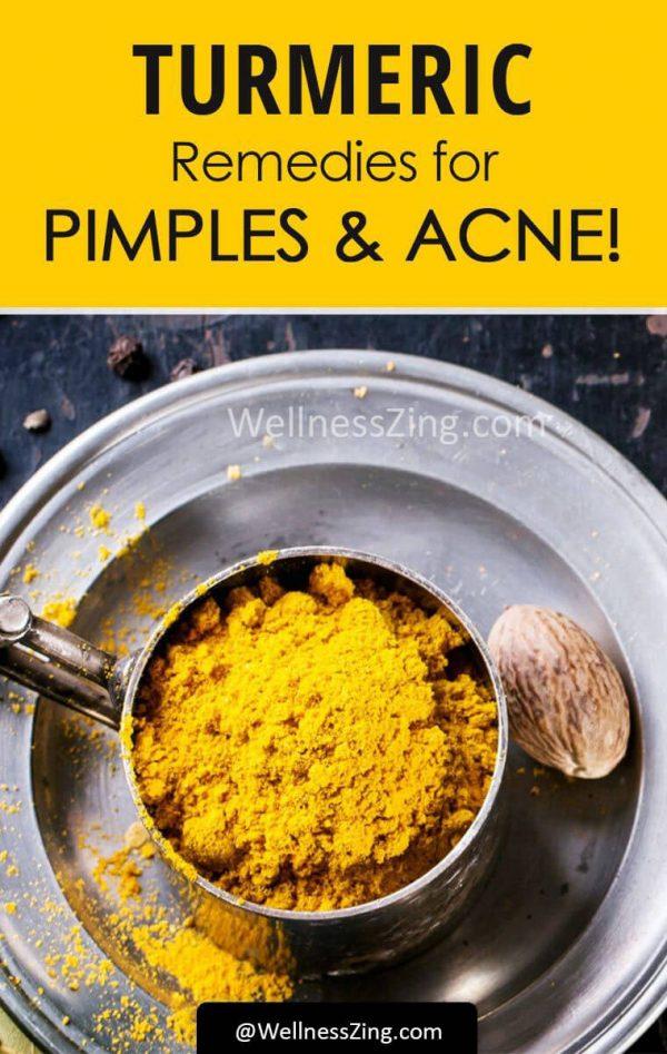 Turmeric Remedies For Acne & Pimples On The Face!