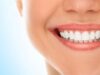 10 Important Tips To Take Care Of Your Teeth And Oral Hygiene!