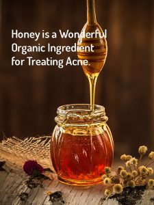Honey for acne treatment