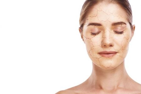 Dry Facial Skin