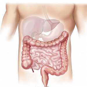 Natural Ways to Clean Colon Using Home Remedies