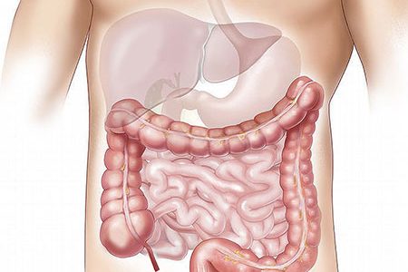 Natural Ways to Clean Colon Using Home Remedies