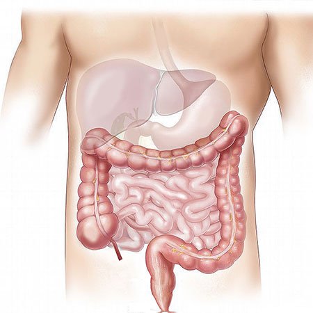 Colon Cleanse : How to Cleanse Your Colon Using Home Remedies