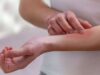 Eczema : Can It Be Treated with Home Remedies?