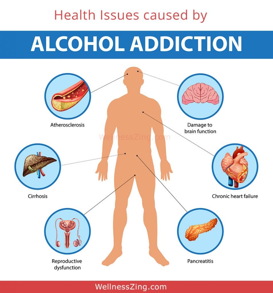 What is Alcohol Addiction, Side Effects and Treatment?