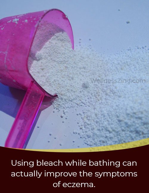 Use Bleach During Bathing for Relief in Eczema