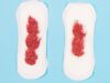Period Bleeding Vs. Implantation Bleeding : What’s the Difference?