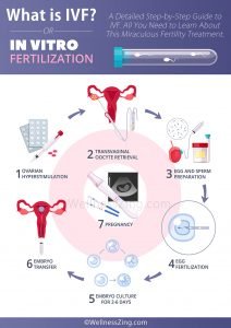 What is IVF Treatment, Success Rate, Risks and Complications