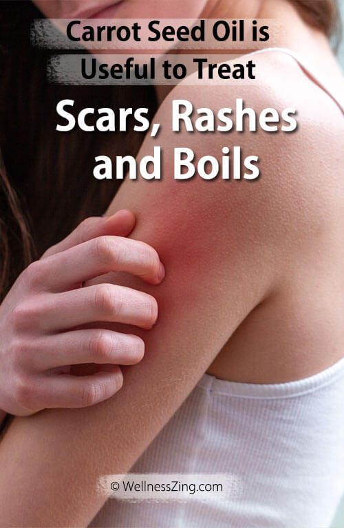 Carrot Seed Oil for Scars Boils and Rashes