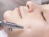 Oxygen Facial : Why is it Beneficial for Radiant and Glowing Skin?