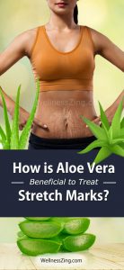 How is Aloe Vera Beneficial For Treating Stretch Marks?