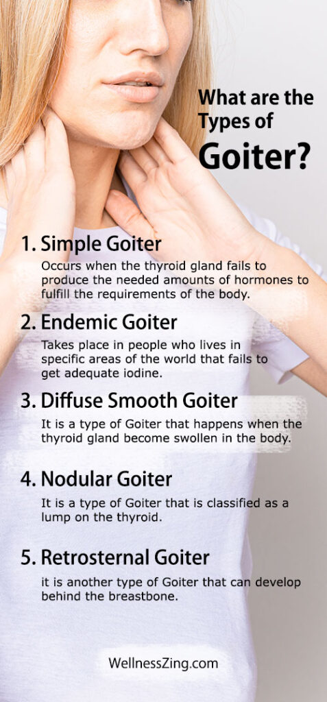 Types Of Goiter Wellnesszing
