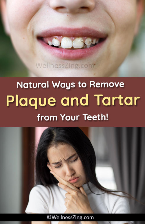 Remove Plaque and Tartar from Teeth with Natural Home Remedies