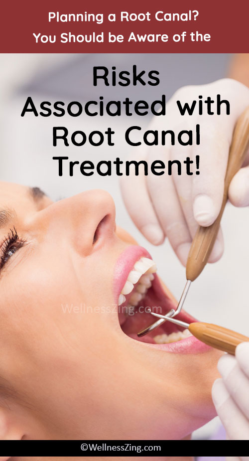 Root Canal Treatment Risks
