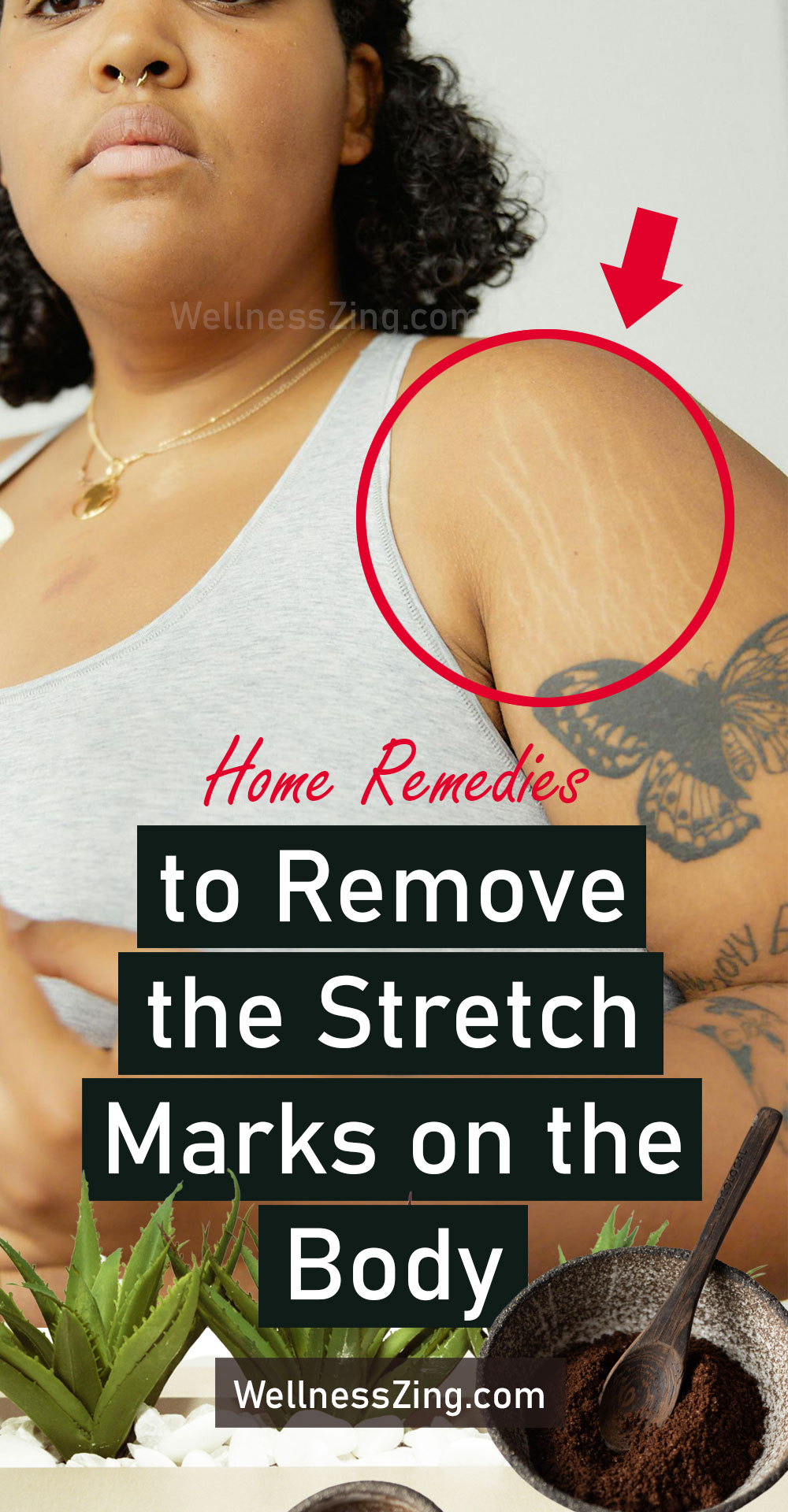 Home Remedies to Remove the Stretch Marks on the Body